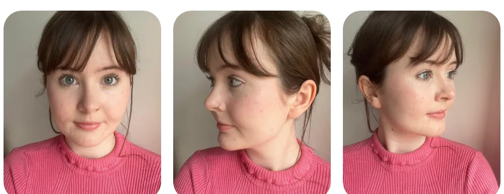 Three skin photos from one day: front, left side and right side