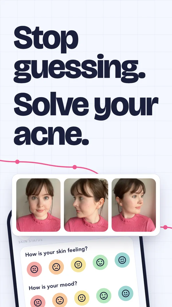 Stop guessing. Solve your acne: the new entry screen with three skin photos and check-ins